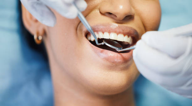 Best Knocked-Out Tooth (Avulsed Tooth) Treatment in Powers Lake, WI